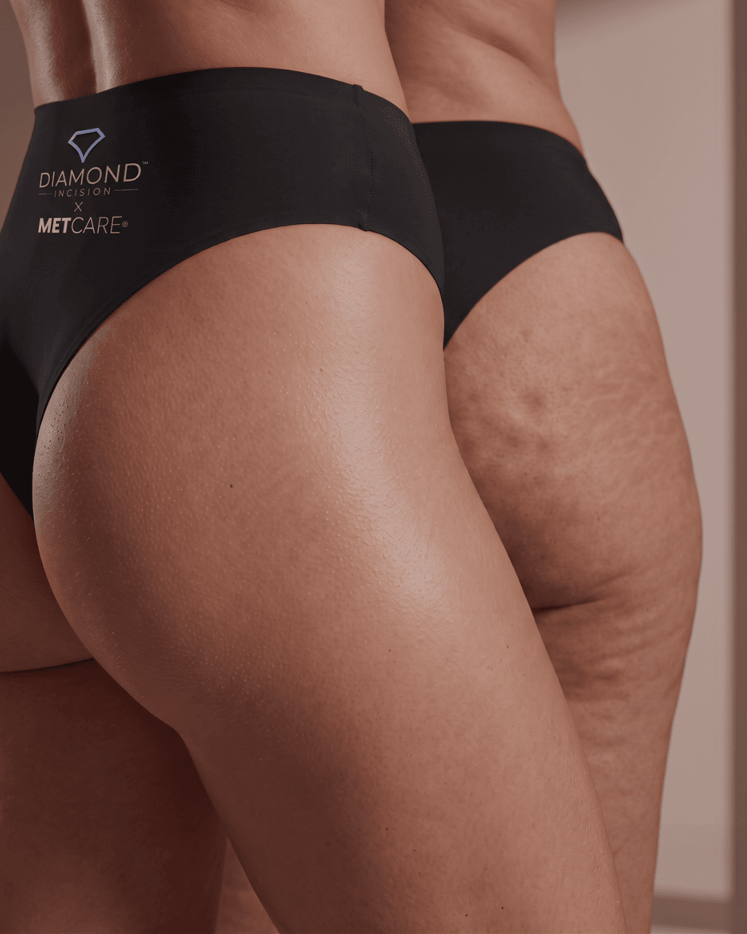 Diamond Incision® × METCARE®